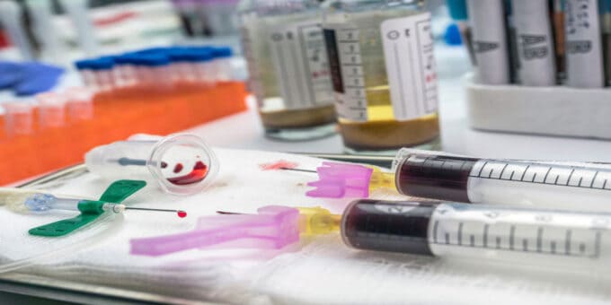 Infected Blood Scandal