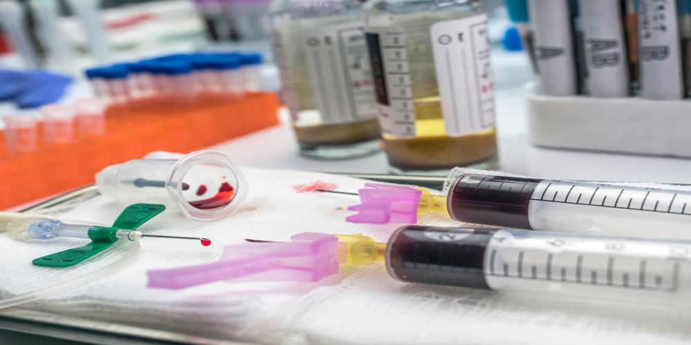 Infected Blood Scandal